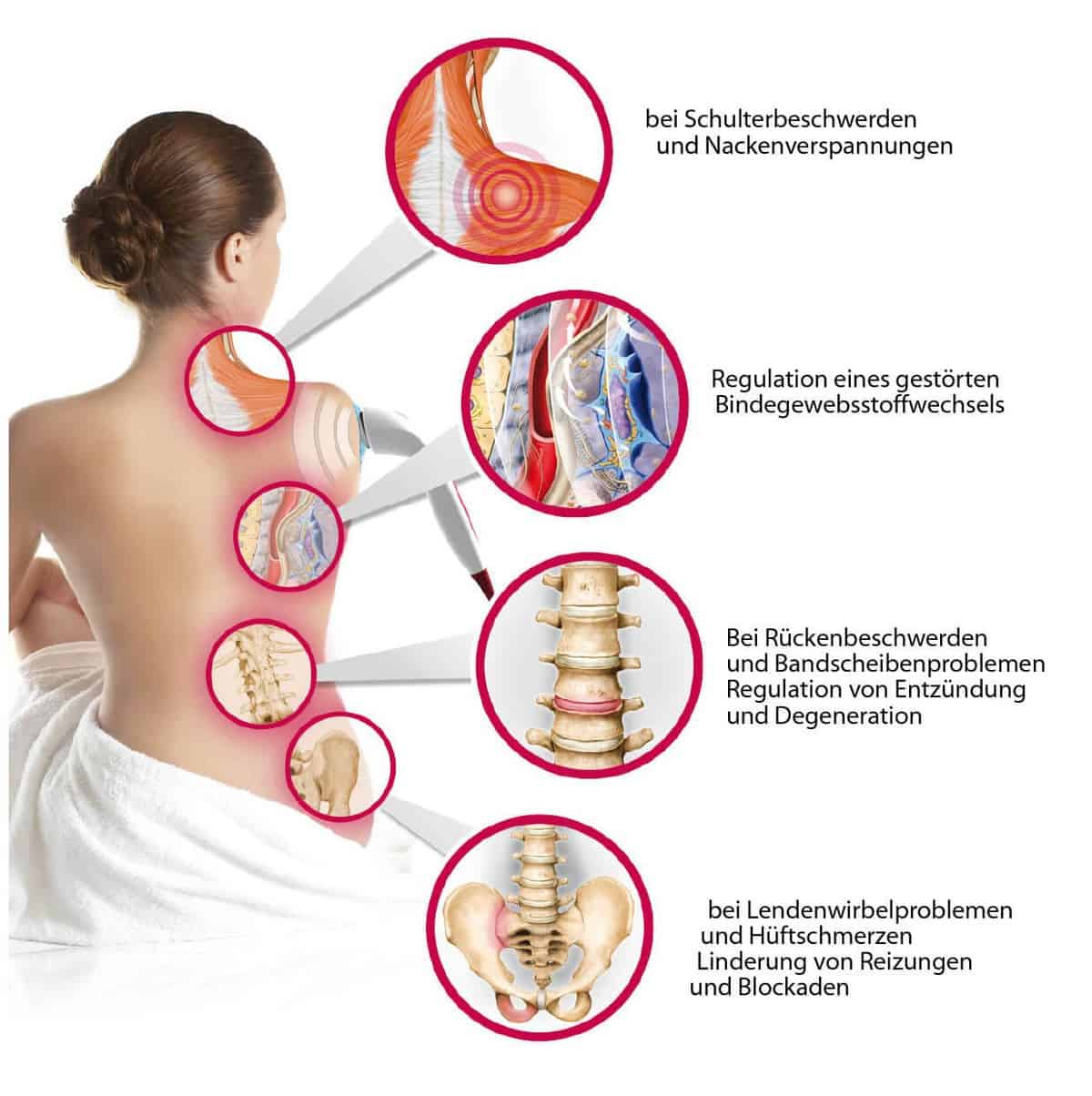 Ursache von Rückenschmerzen und die Psyche Bild von Anwendungsmöglichkeiten der Vitalwellentherapie